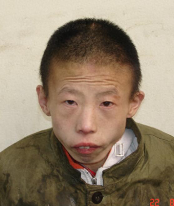 走失者照片 晋中市寻亲：青年男子被救助，患脑瘫...