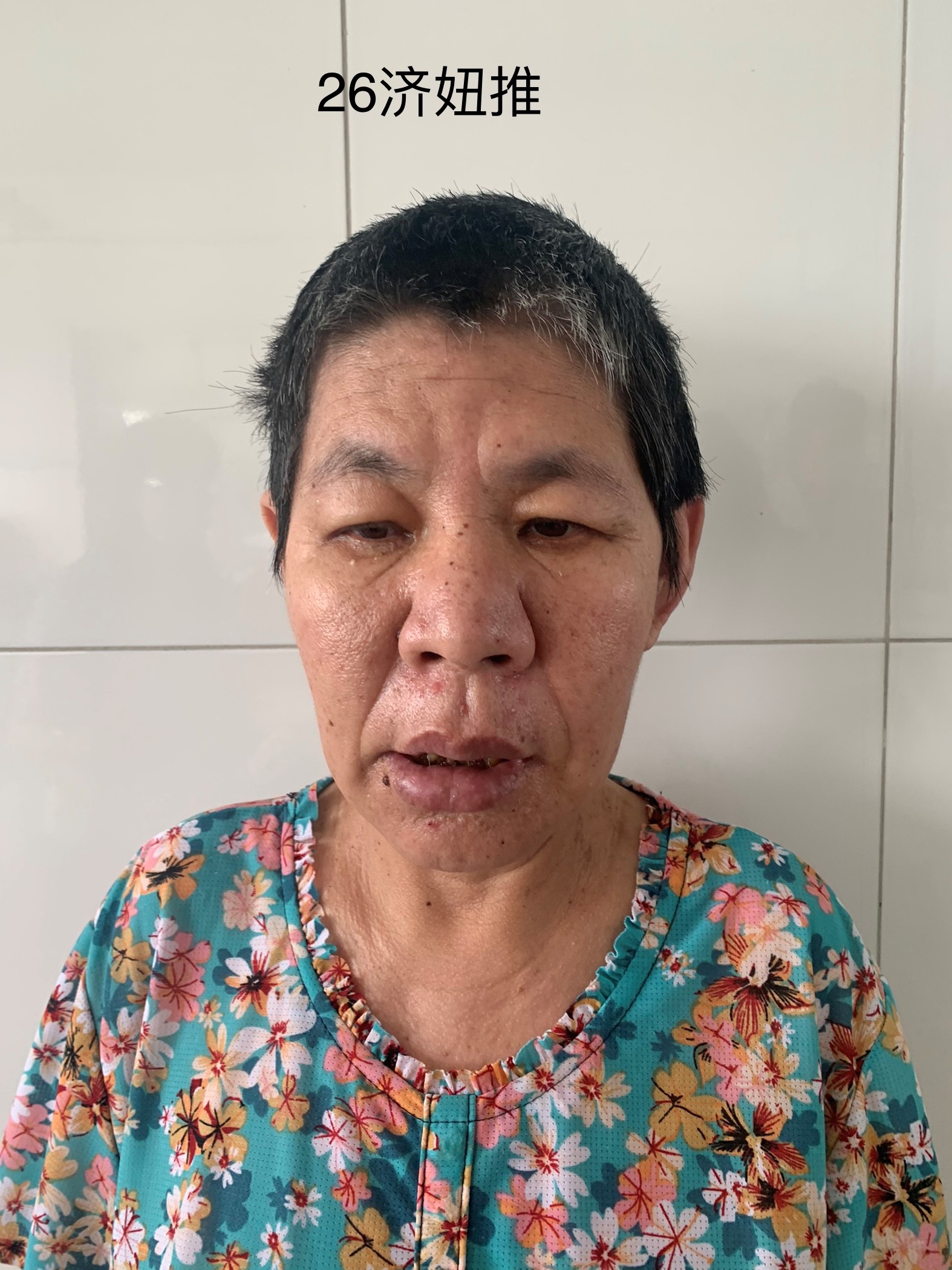 走失者照片 济南市寻亲：中年女子被救助，自述叫...