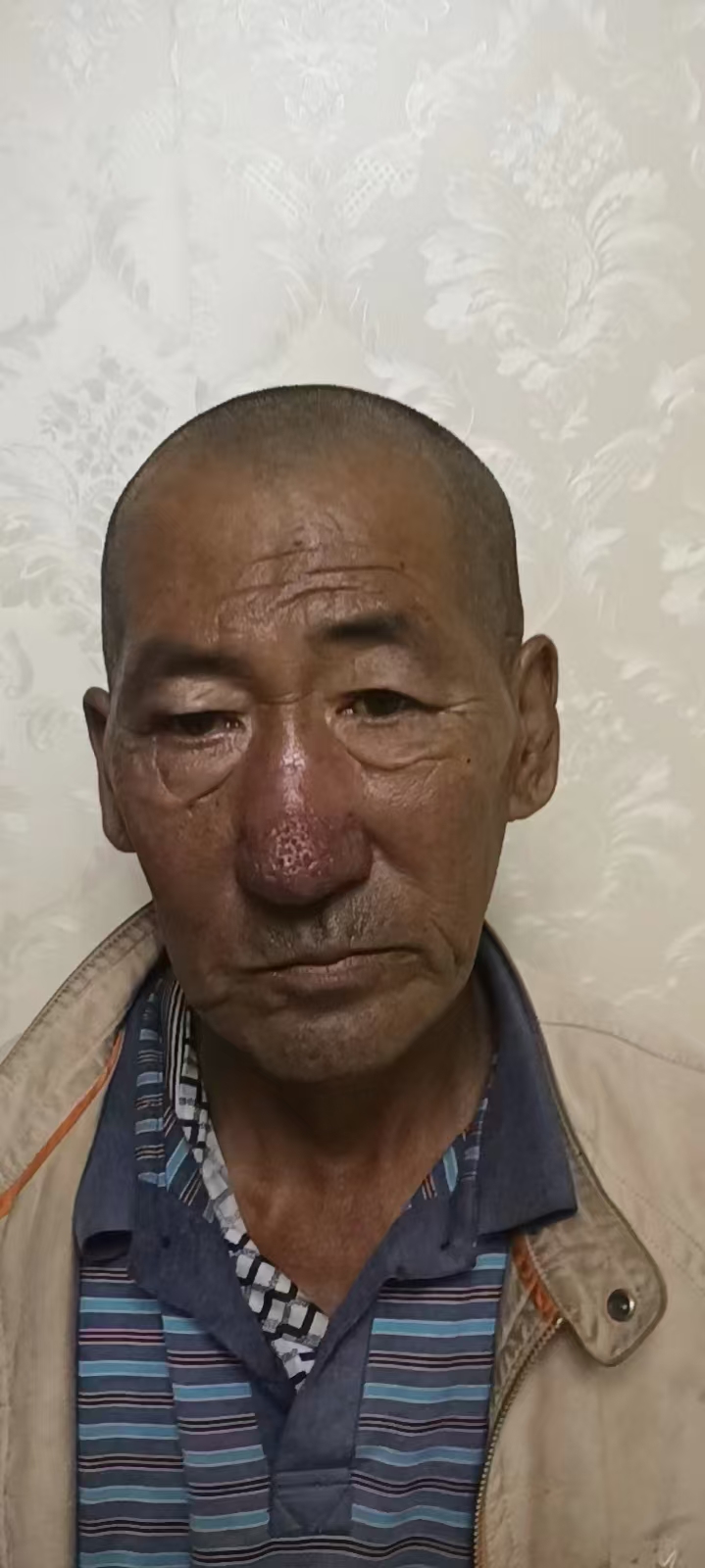 走失者照片 长春市寻人：六旬老人走失，患脑梗，...