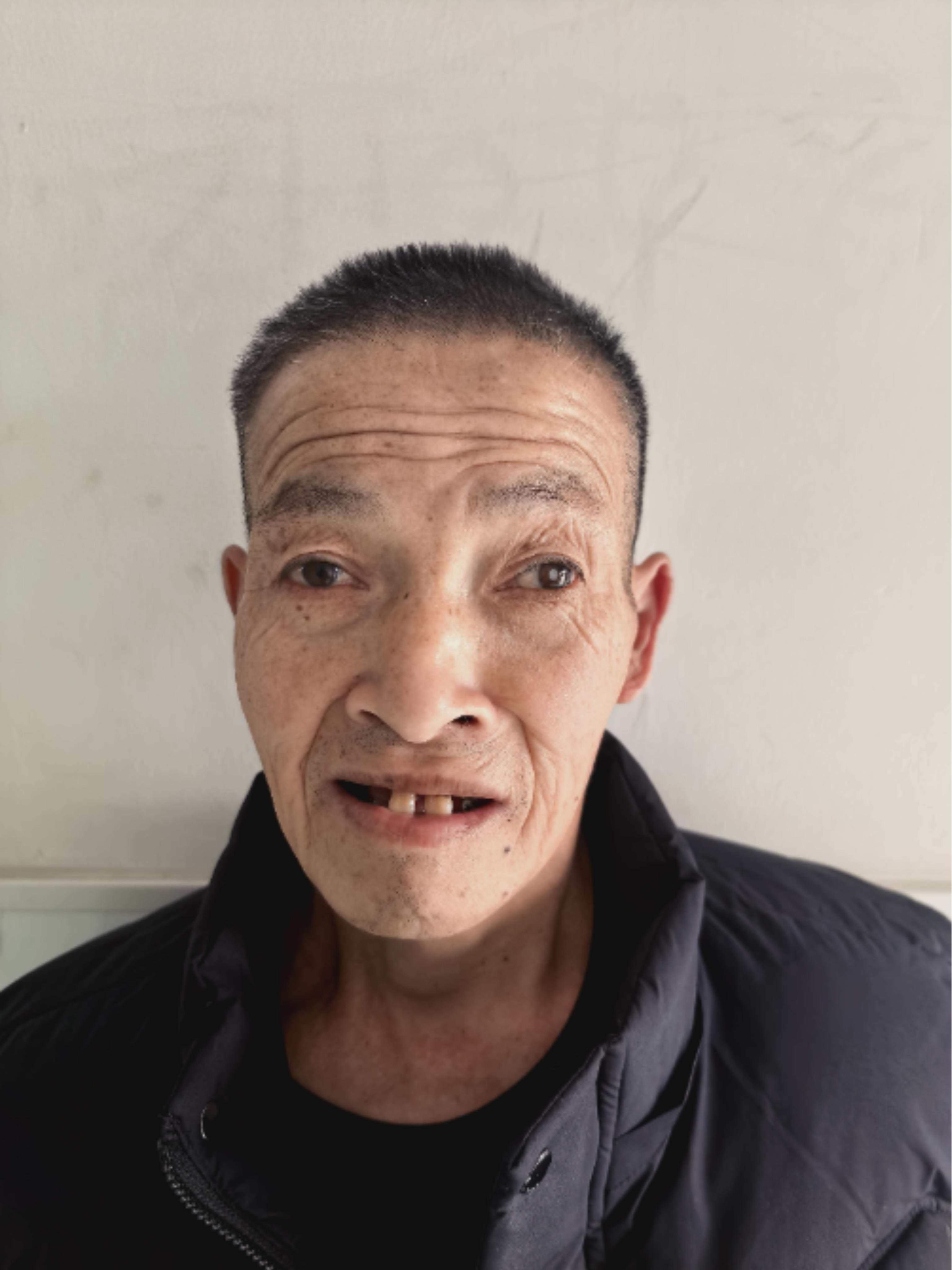 走失者照片 北京市寻亲：中年男子被救助，疑似湖...