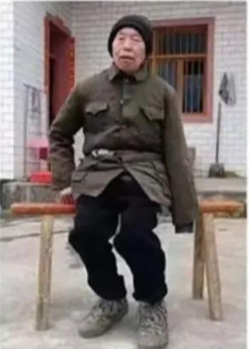 走失者照片 广安市寻人：八旬老人走失，左手残疾...