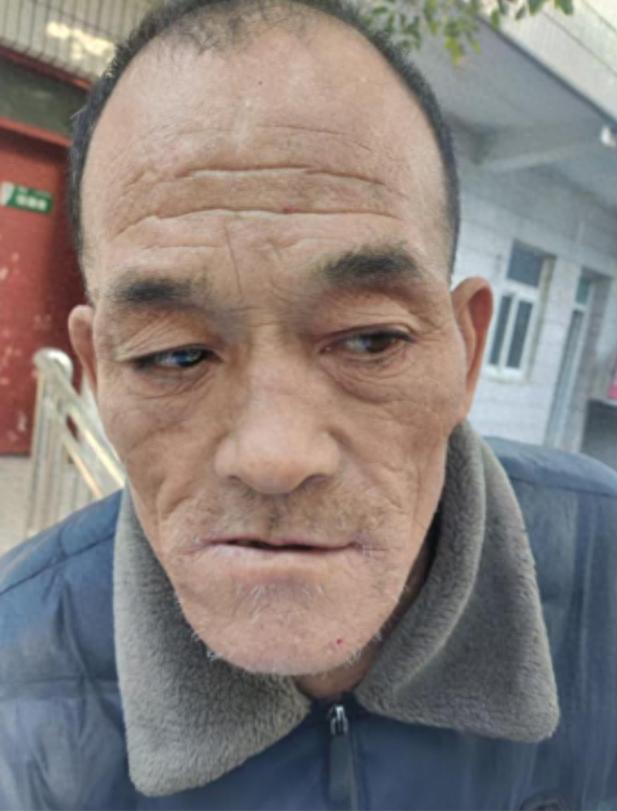 走失者照片 郑州市寻亲：七旬老人被救助，疑患智...