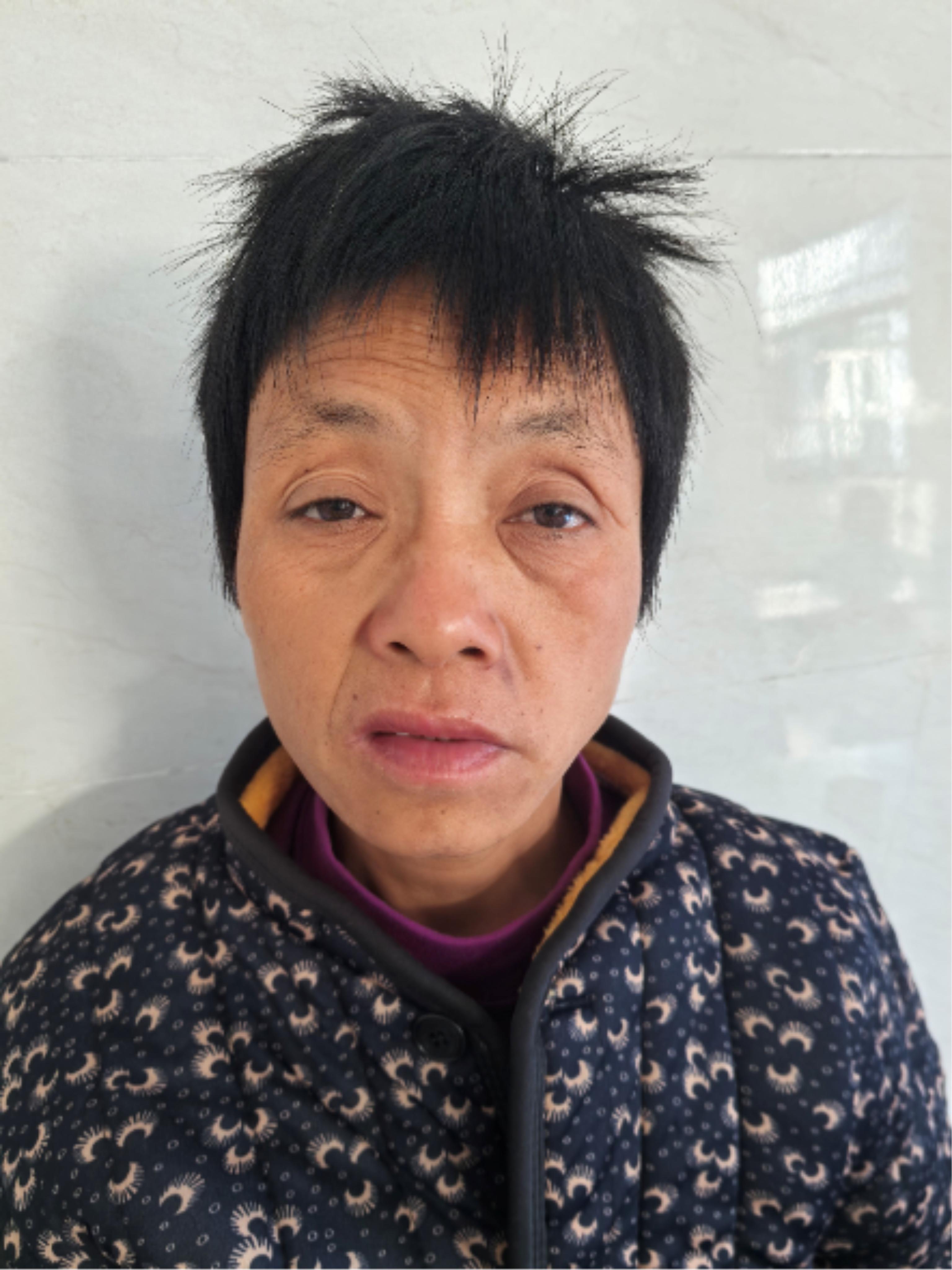 走失者照片 六安市寻亲：五旬女子被救助，疑似精...