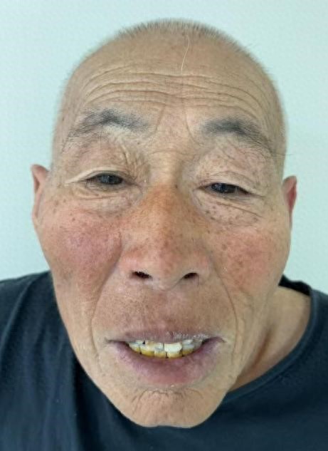 走失者照片 北京市寻亲：六旬老人被救助，自述叫...