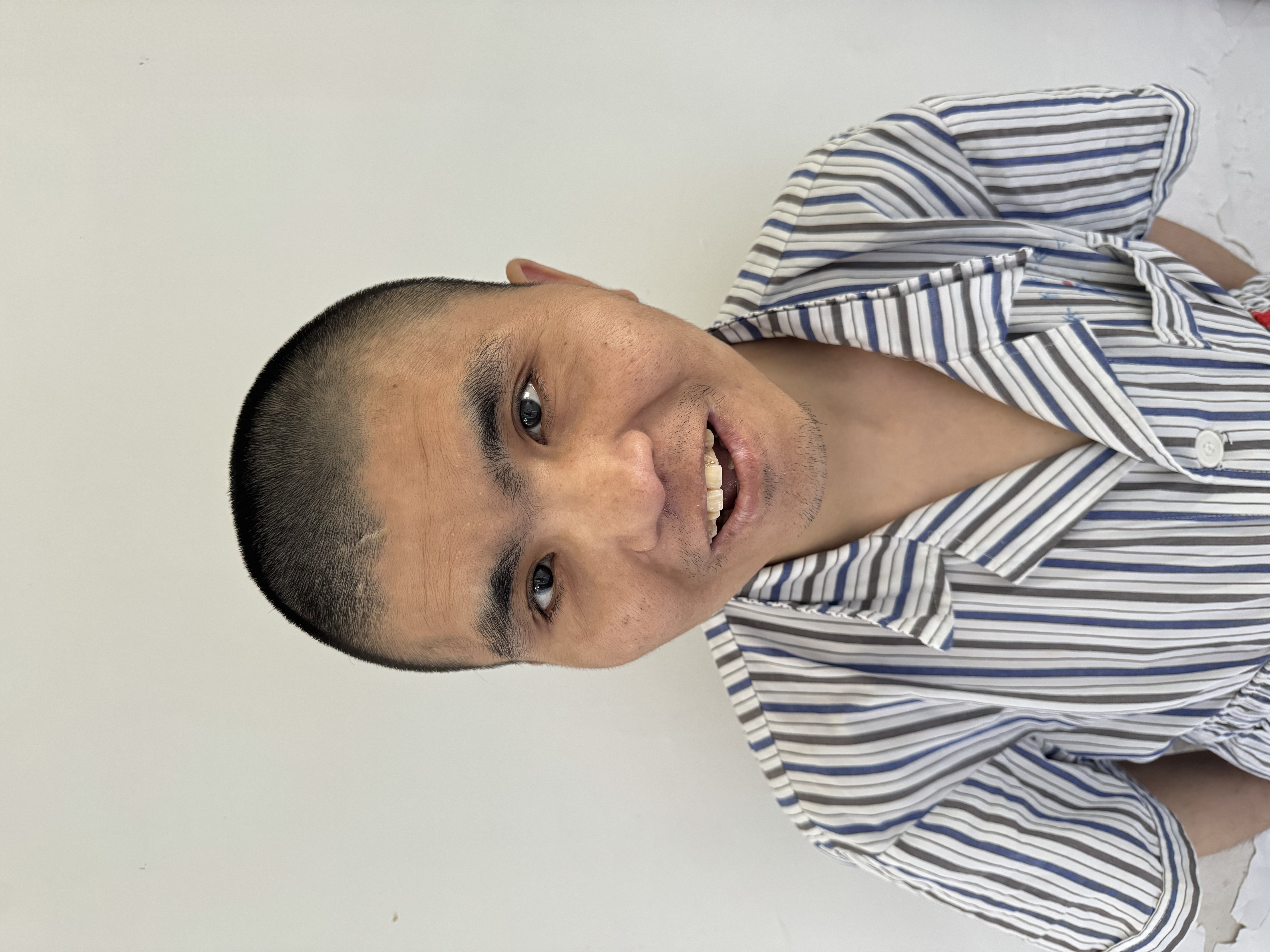 走失者照片 济宁市寻亲：青年男子被救助，高1米...