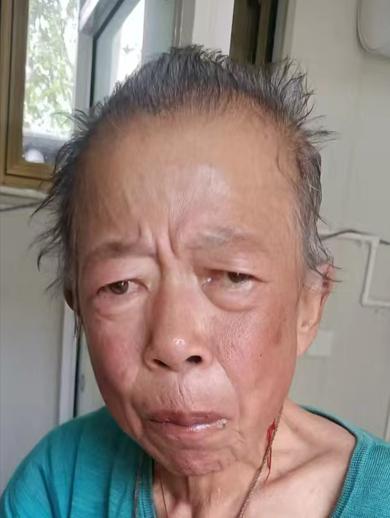 走失者照片 秦皇岛市寻亲：七旬老太被救助，自述...
