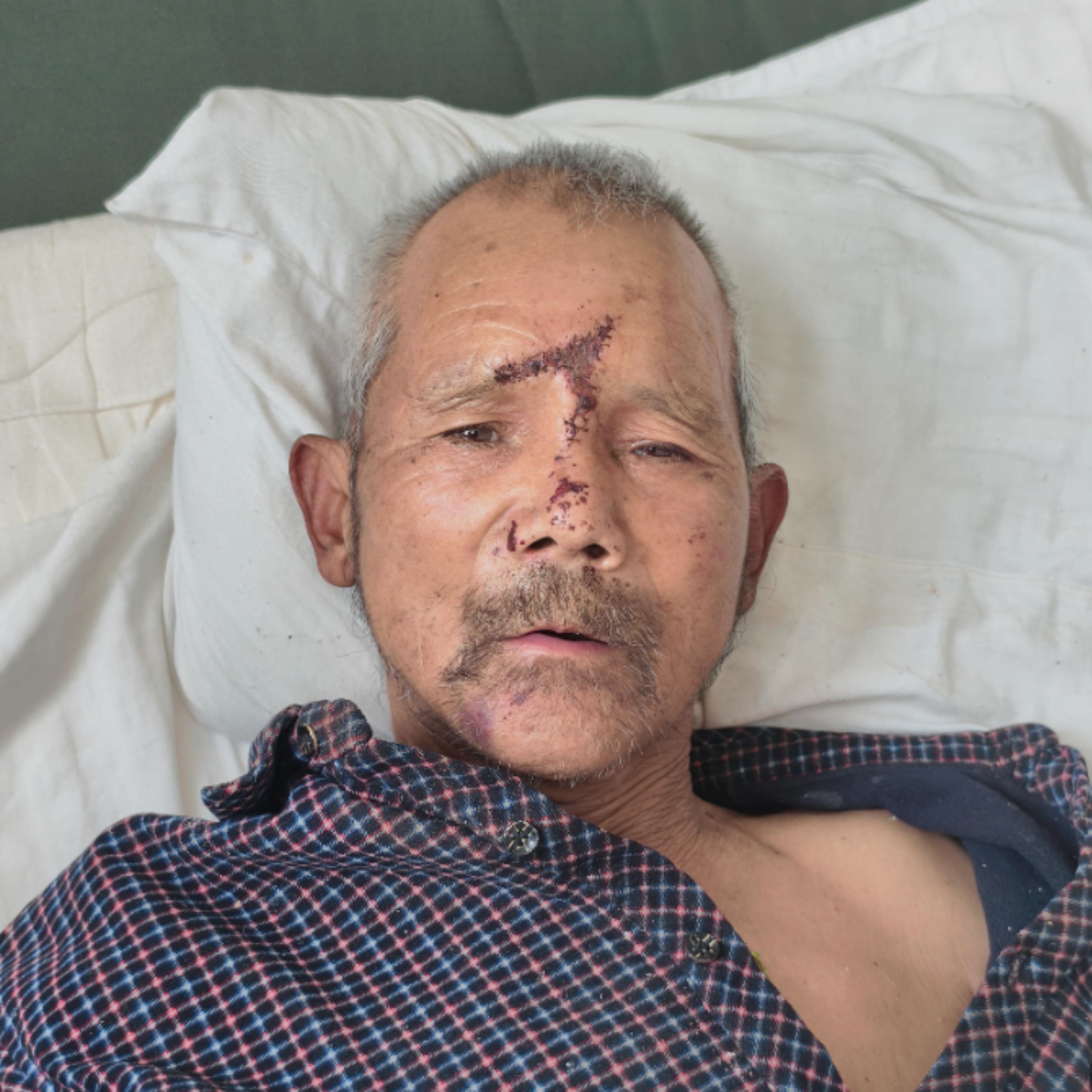 走失者照片 宝鸡市寻亲：六旬老人被救助，高1米...