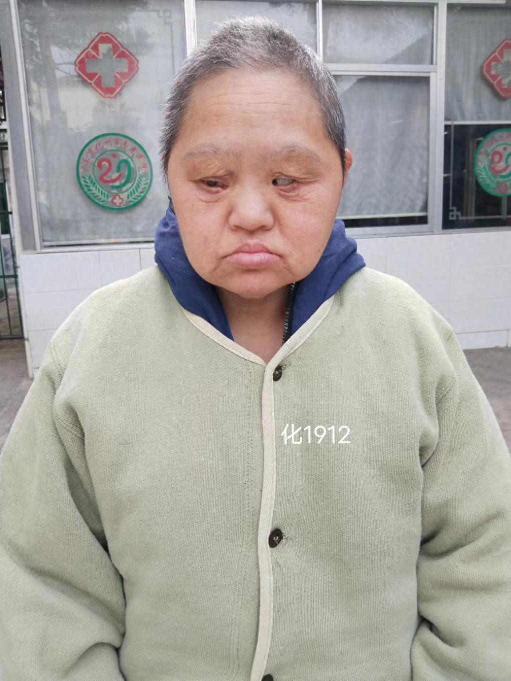 走失者照片 茂名市化州市寻亲：中年女子被救助，...