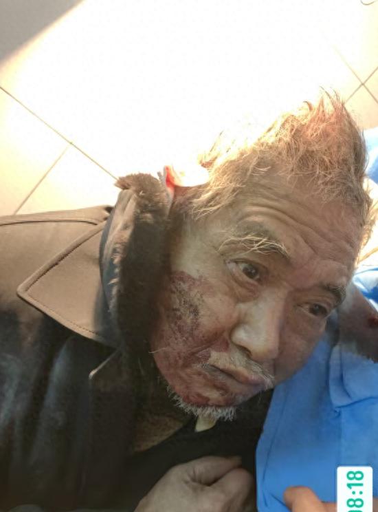 走失者照片 哈尔滨市寻亲：七旬老人被救助，穿蓝...