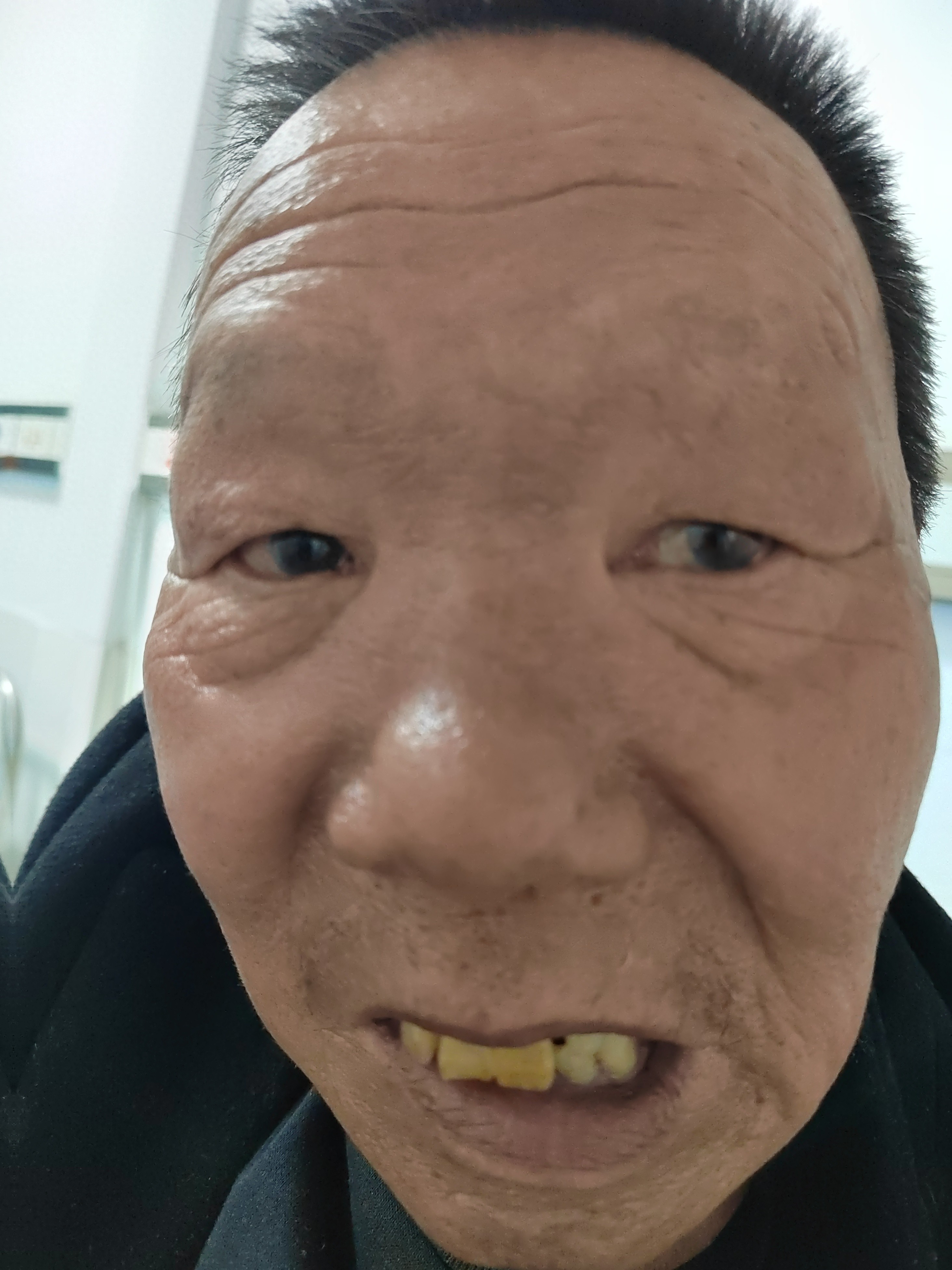 走失者照片 衡阳市耒阳市寻亲：七旬老人被救助，...