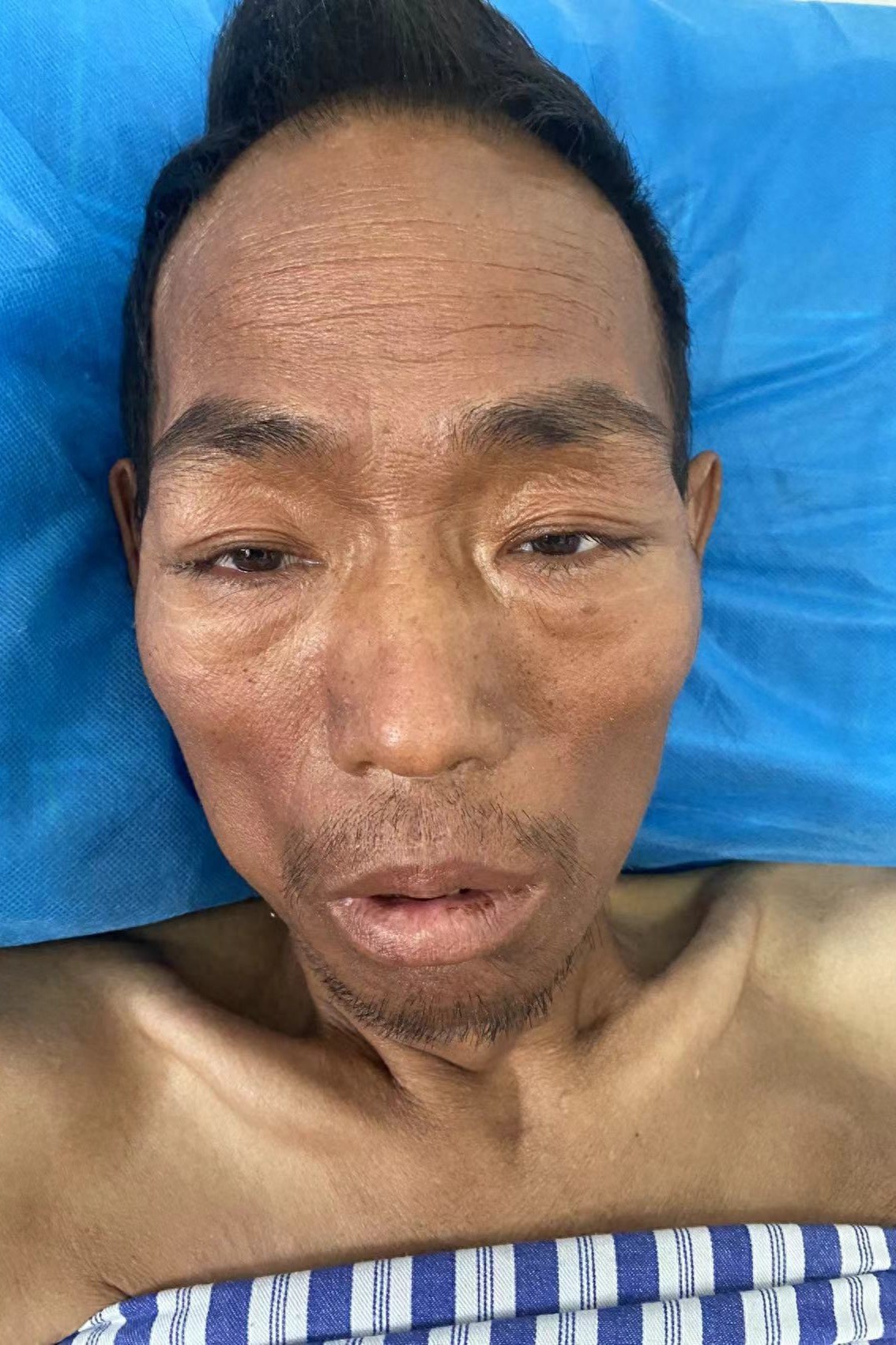 走失者照片 桂林市寻亲：五旬男子被救助，穿白色...