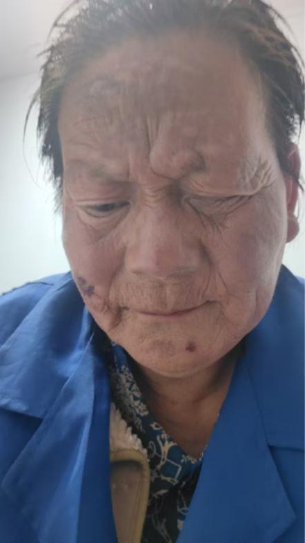 走失者照片 周口市寻亲：五旬女子被救助，疑患精...