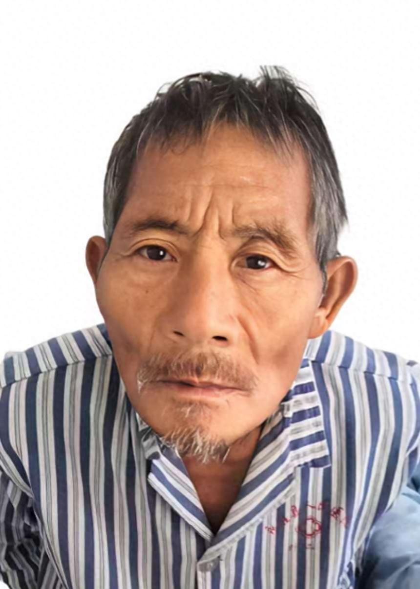 走失者照片 丽江市寻亲：六旬老人被救助，疑似精...