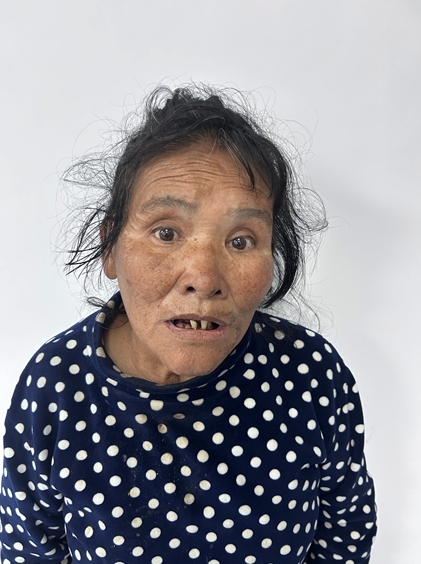 走失者照片 湛江市廉江市寻亲：六旬老太被救助，...