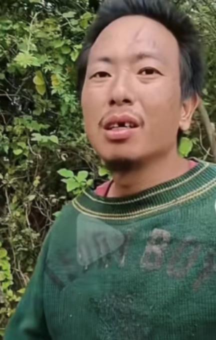 走失者照片 九江市庐山市寻人：青年男子走失，患...
