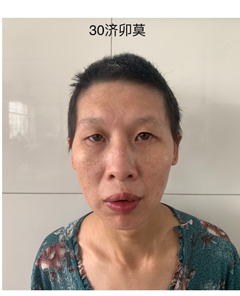 走失者照片 济南市寻亲：青年女子被救助，高1米...