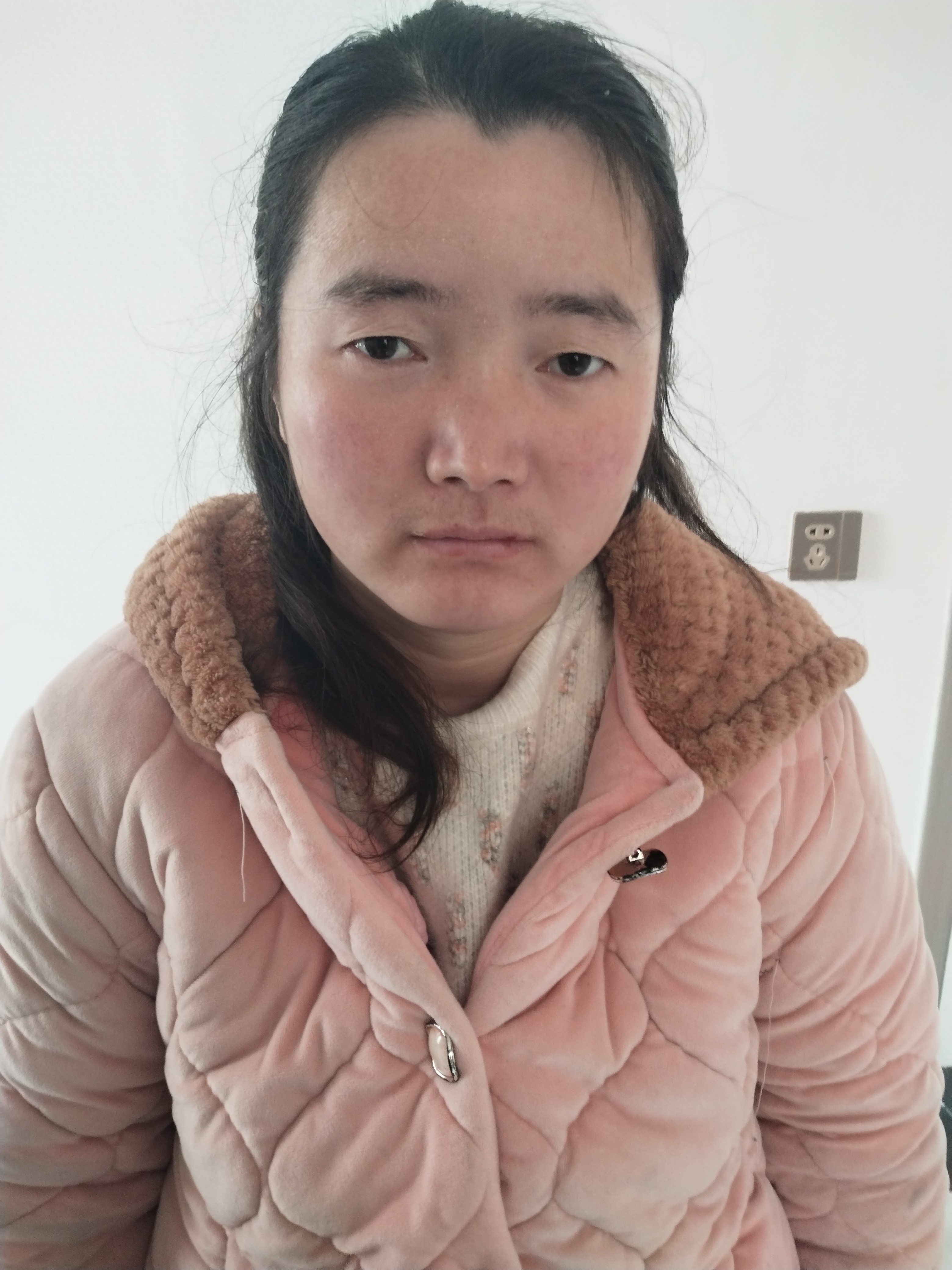 走失者照片 亳州市寻人：青年女子走失，患精神障...