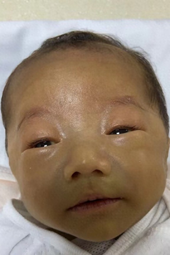 走失者照片 玉林市寻亲：约2个月大男婴被救助，...