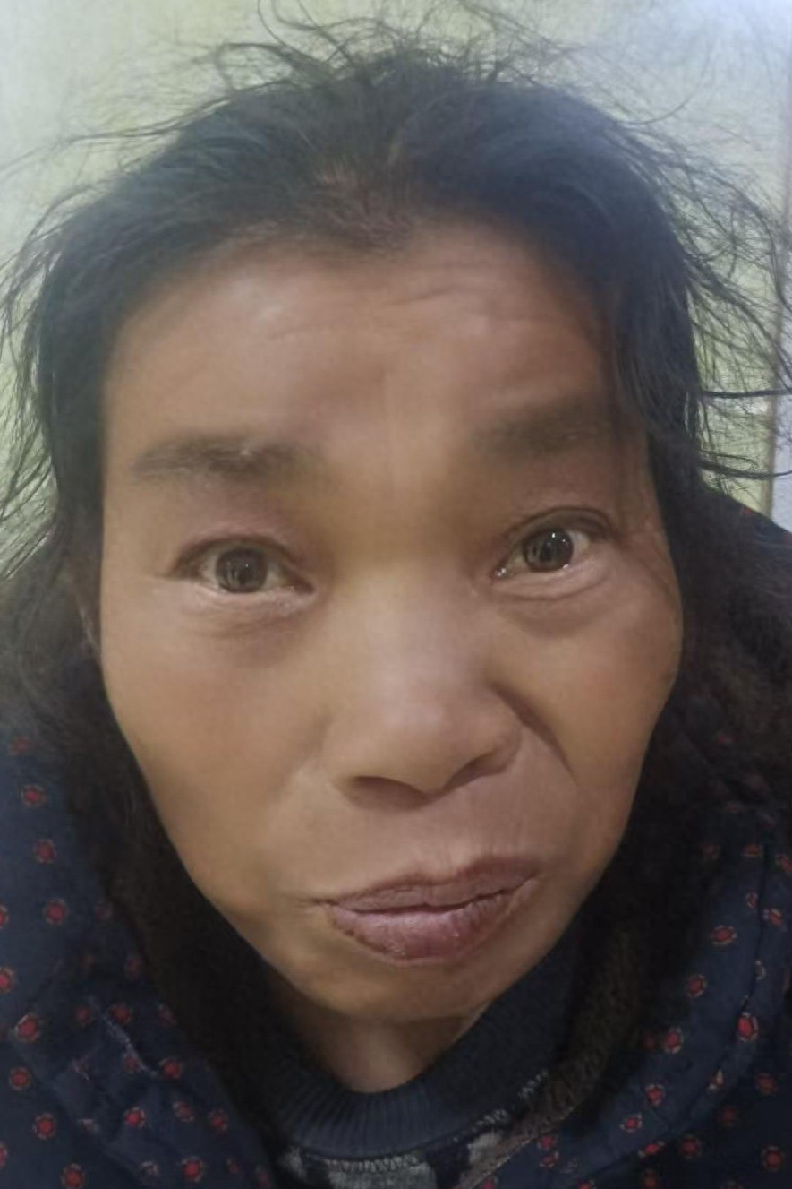 走失者照片 南阳市寻亲：五旬女子被救助，高1米...