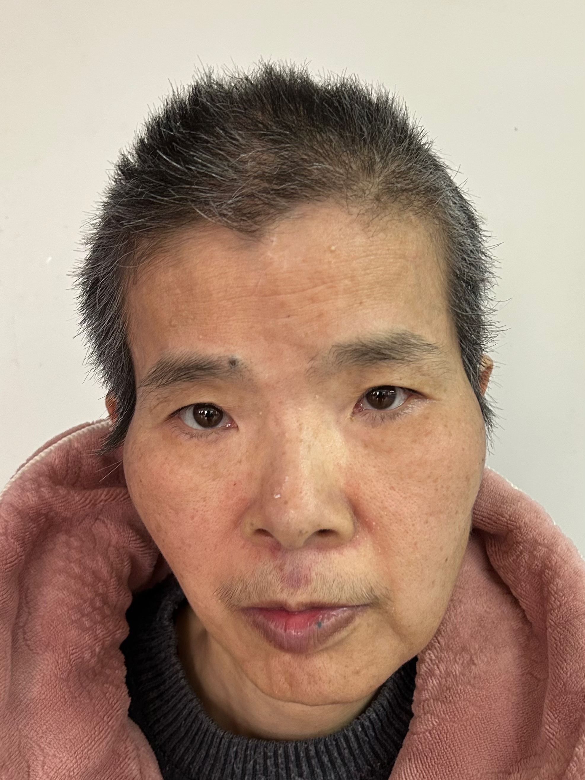 走失者照片 福州市寻亲：五旬女子被救助，高1米...