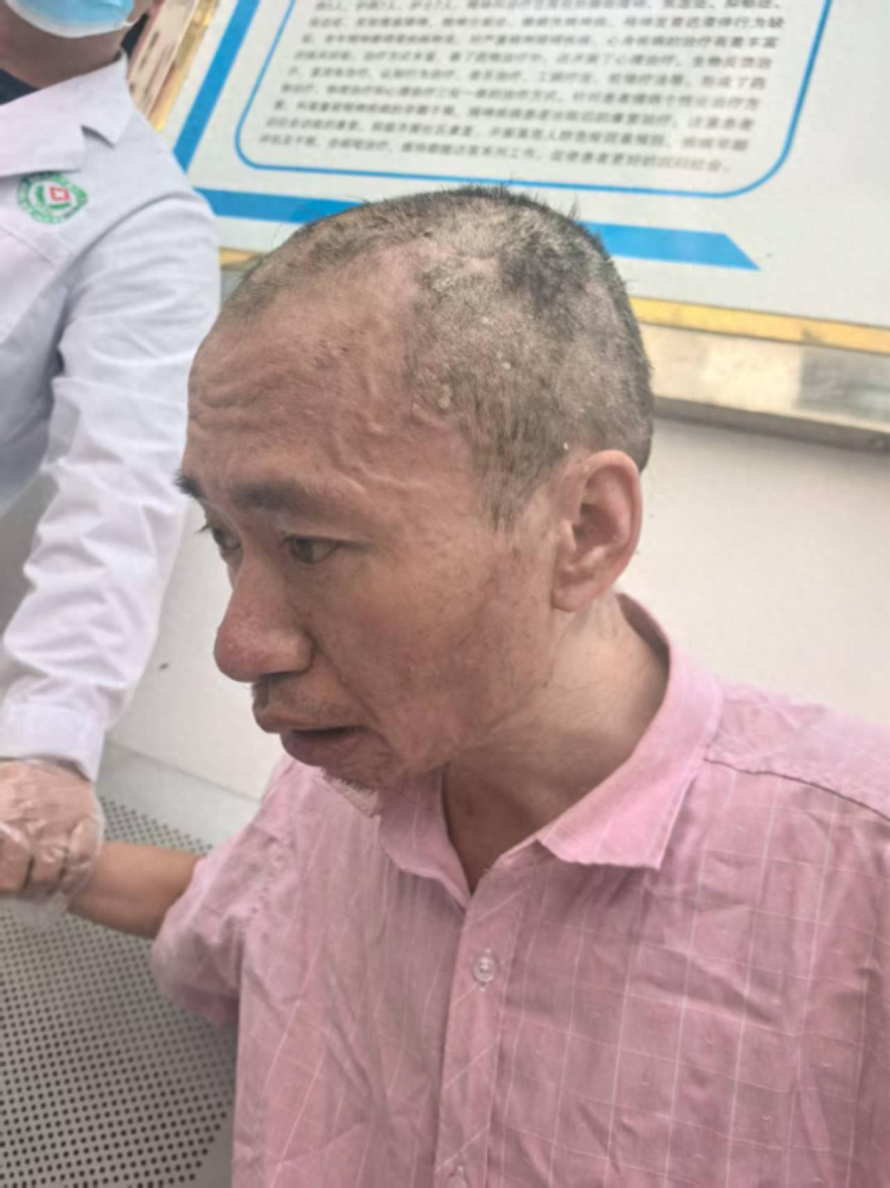 走失者照片 凉山州会理市寻亲：五旬男子被救助，...