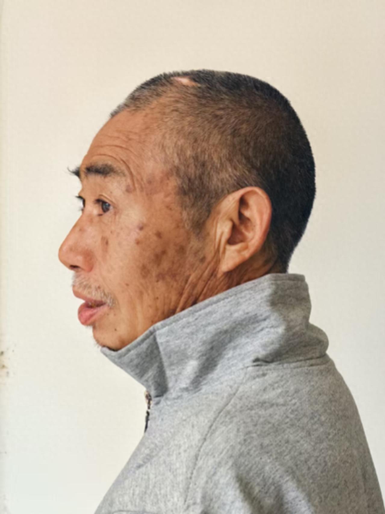 走失者照片 曲靖市寻亲：七旬老人被救助，自述叫...
