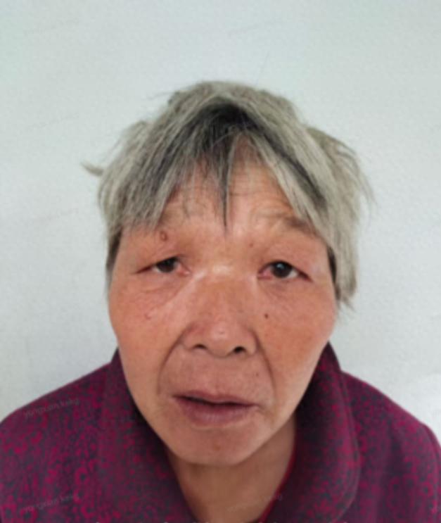 走失者照片 商丘市寻亲：七旬老太被救助，疑患智...