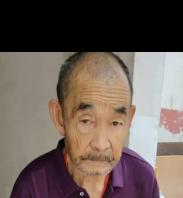 走失者照片 大理州大理市寻人：八旬老人走失，戴...