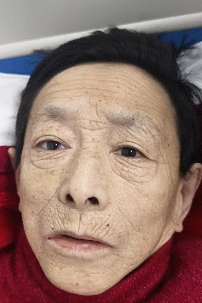 走失者照片 伊春市寻亲：七旬老人被救助，自述叫...