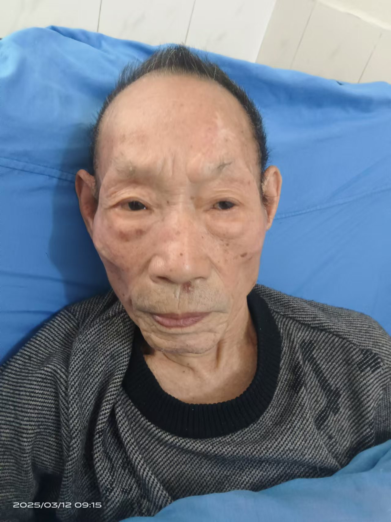 走失者照片 南阳市寻亲：七旬老人被救助，穿蓝黄...