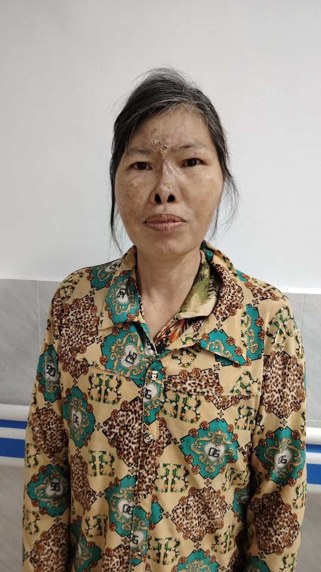 走失者照片 阳江市寻亲：五旬女子被救助，疑似茂...