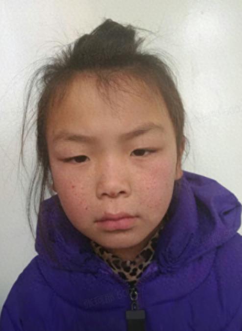 走失者照片 晋中市寻亲：青年女子被救助，沟通困...