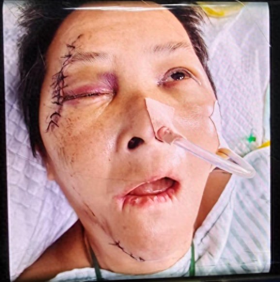 走失者照片 贵港市桂平市寻亲：五旬女子被救助，...