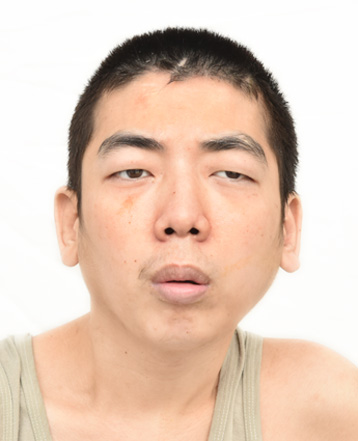 走失者照片 汕头市寻亲：青年男子被救助，高1米...