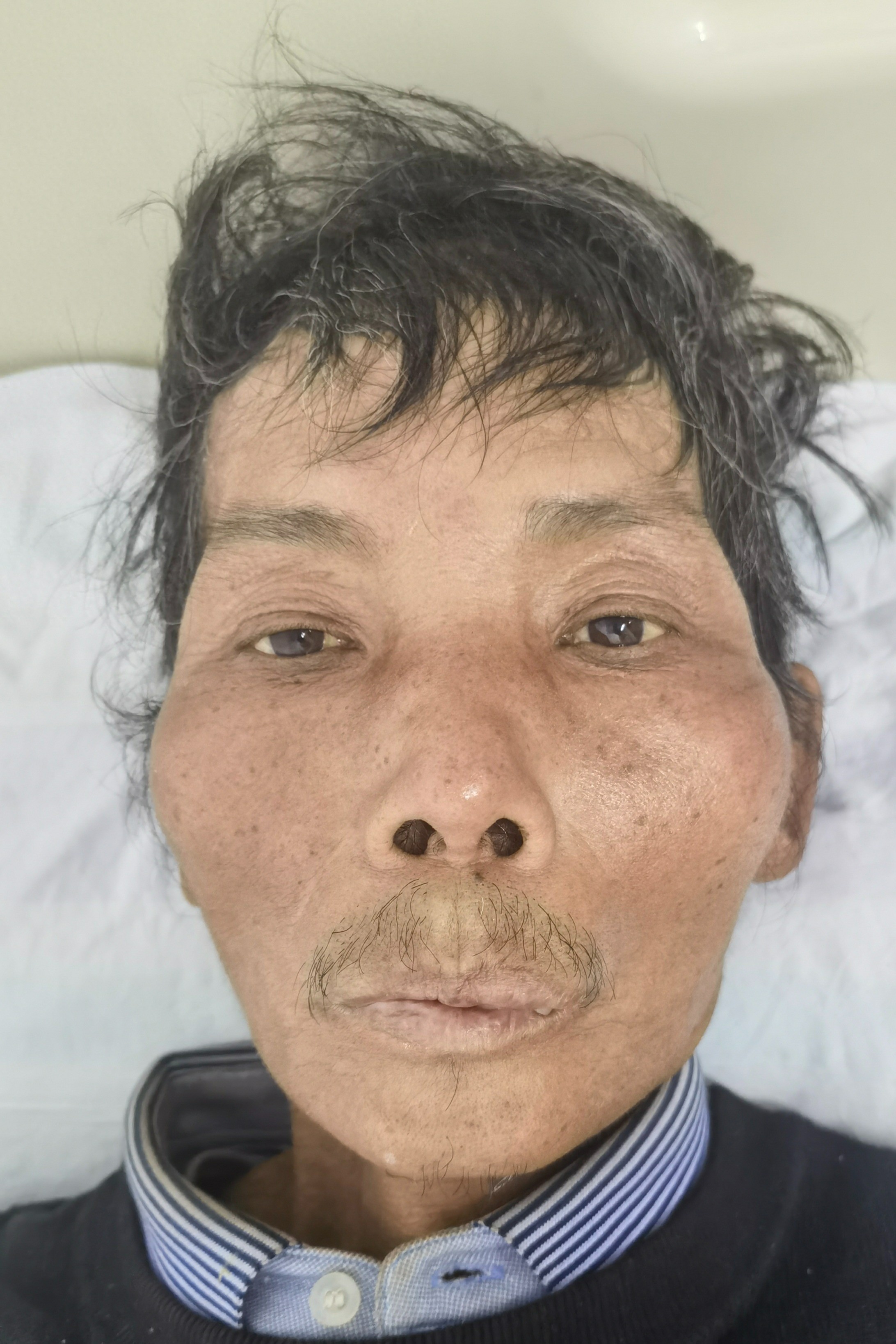 走失者照片 海口市寻亲：六旬老人被救助，穿深灰...