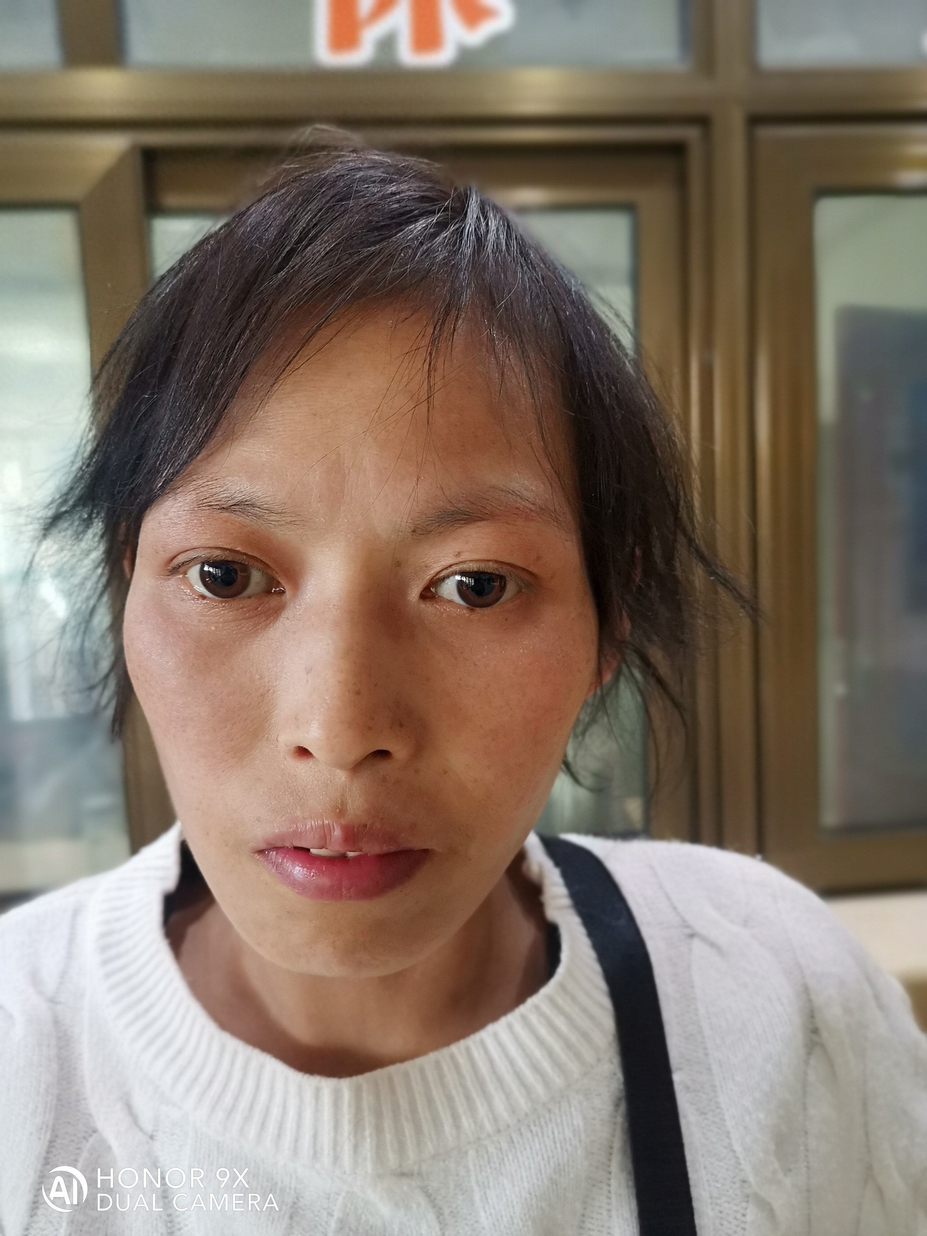 走失者照片 宿州市寻亲：中年女子被救助，疑似广...