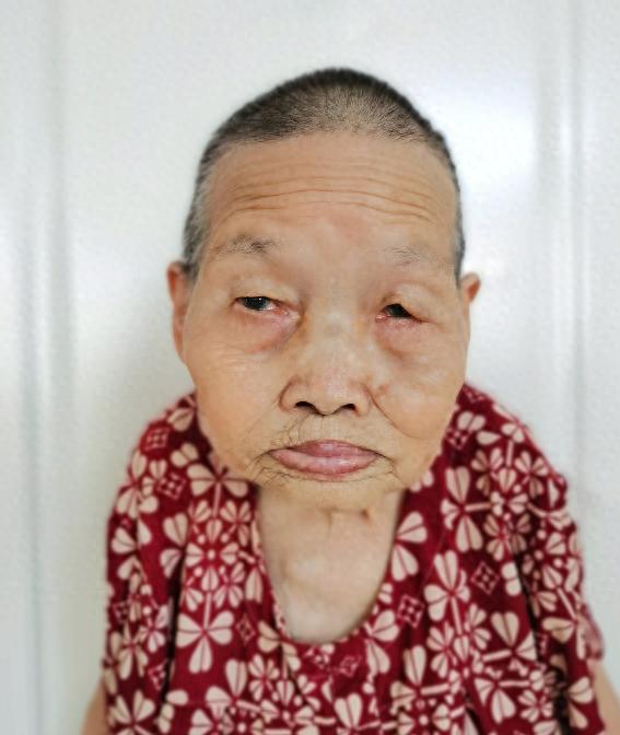 走失者照片 北海市寻亲：九旬老太被救助，穿花上...
