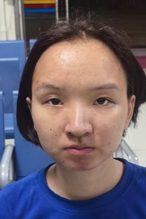 走失者照片 全国救助站