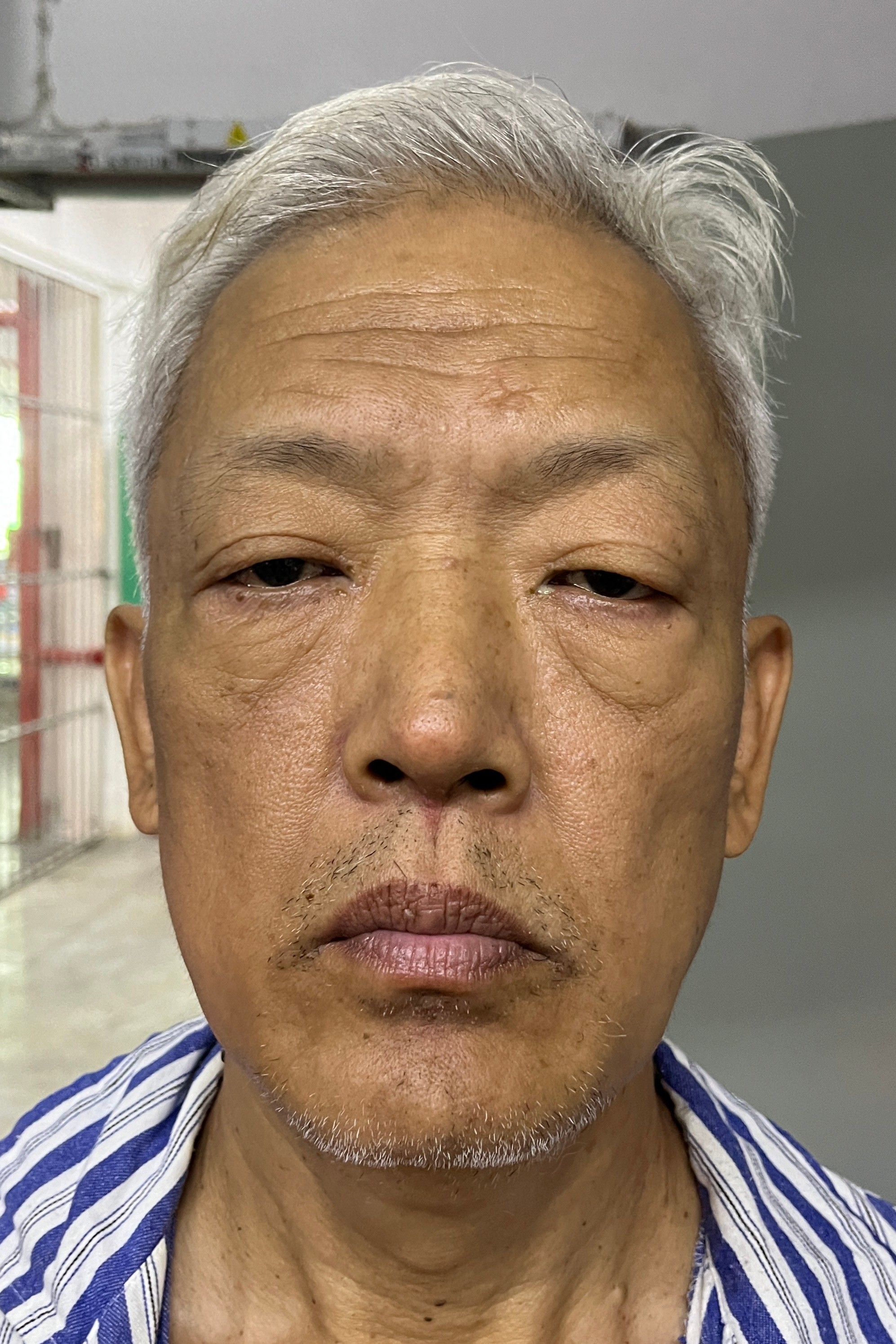 走失者照片 海口市寻亲：五旬男子被救助，自述叫...