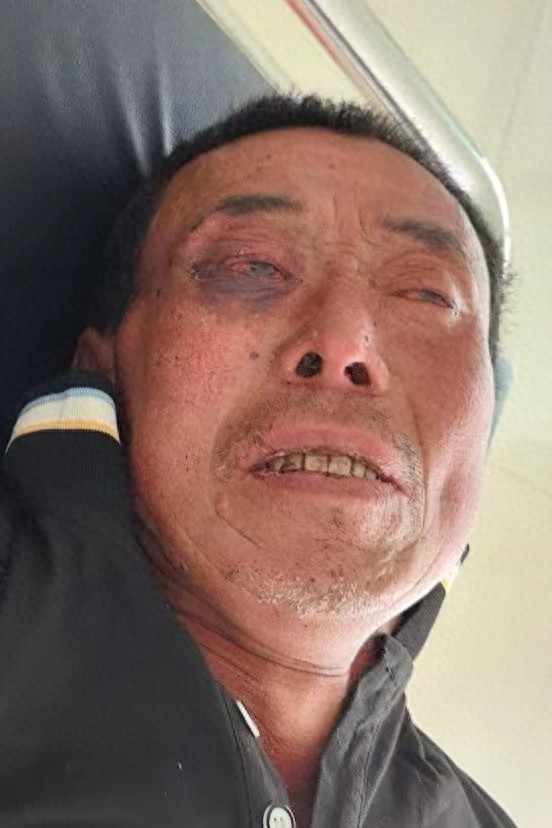 走失者照片 呼伦贝尔市寻亲：六旬老人被救助，自...