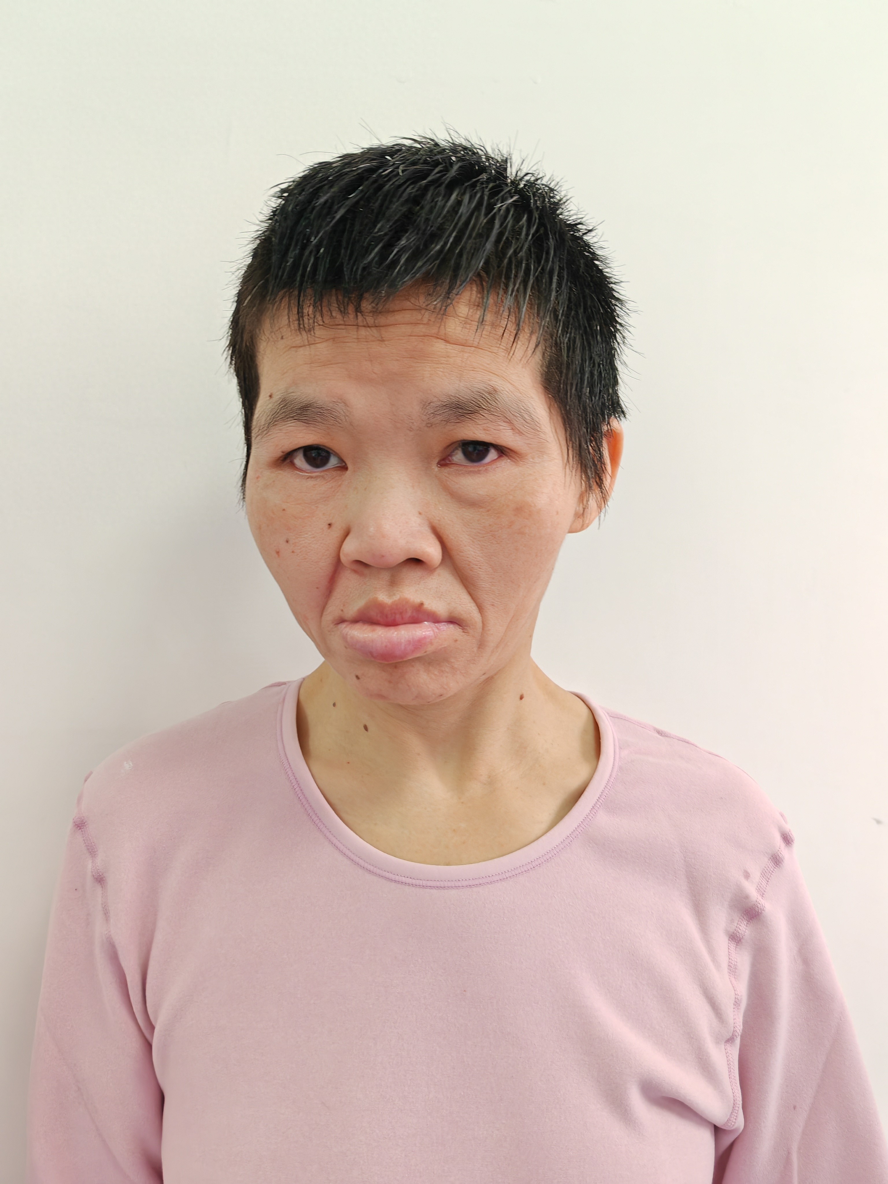 走失者照片 北京市寻亲：青年女子被救助，高1米...
