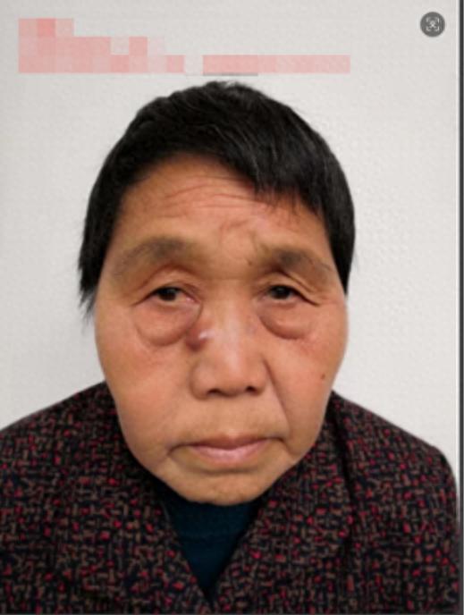 走失者照片 南通市寻亲：六旬老太被救助，自述叫...