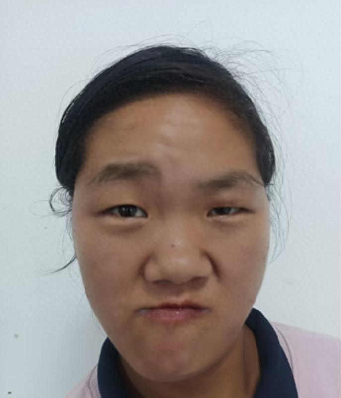 走失者照片 宿迁市寻亲：青年女子被救助，疑患脑...