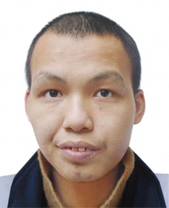 走失者照片 东莞市寻亲：青年男子被救助，疑似姓...