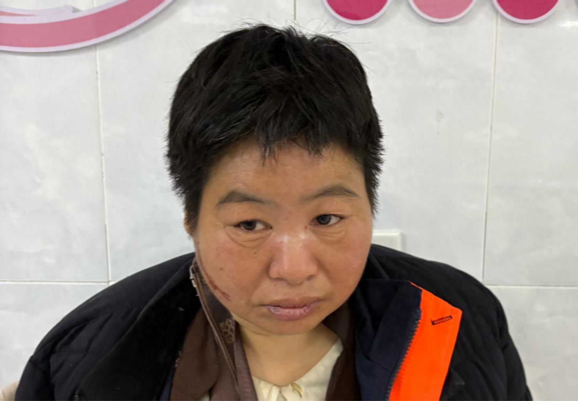 走失者照片 梧州市寻亲：中年女子被救助，穿黑色...