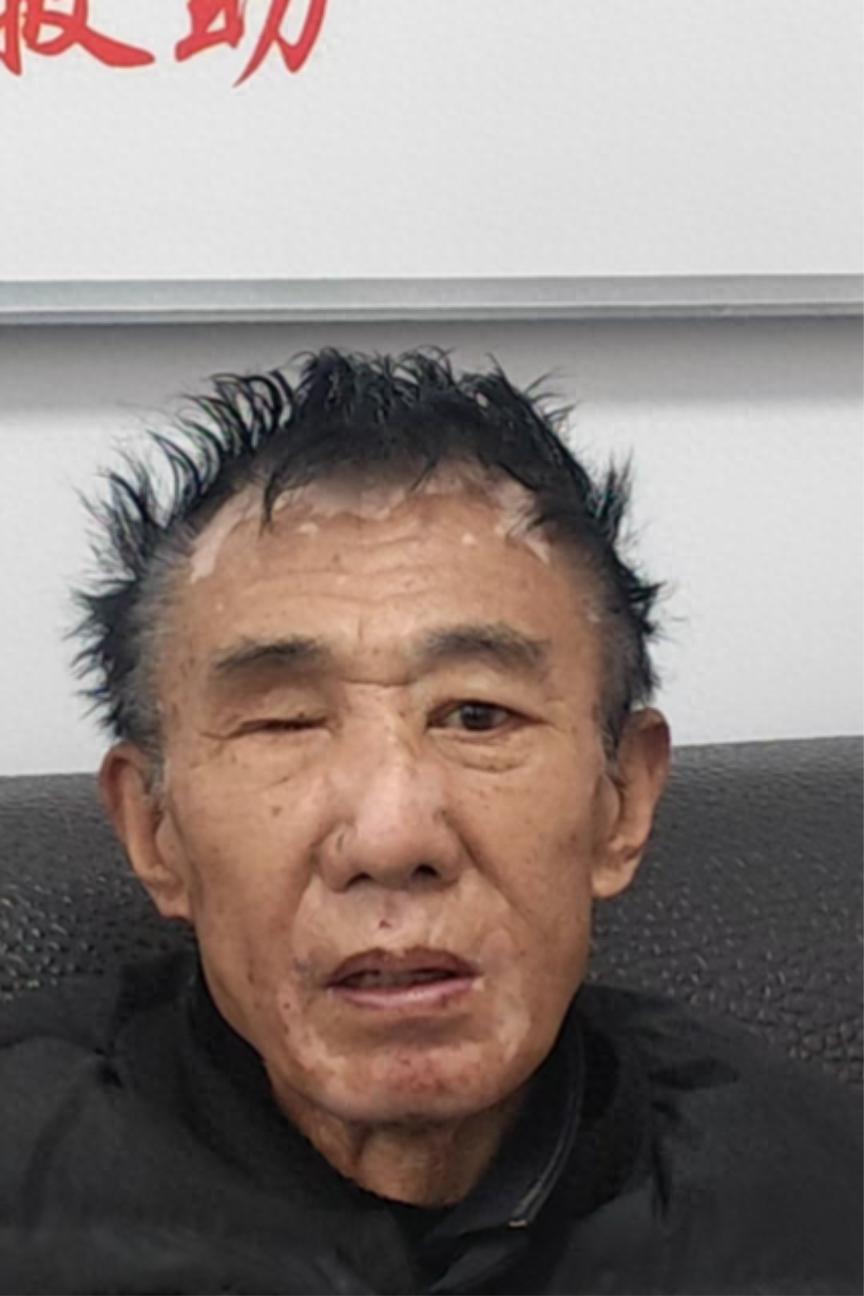 走失者照片 鹤岗市寻亲：七旬老人被救助，自述叫...