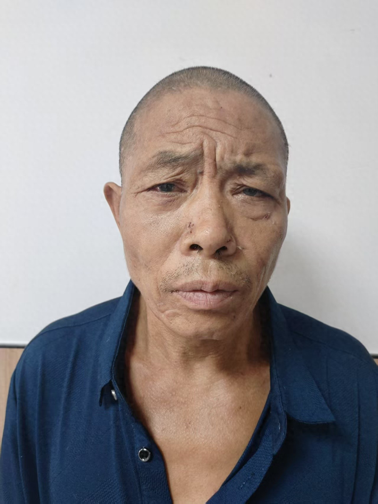 走失者照片 淮北市寻亲：中年男子被救助，高约1...