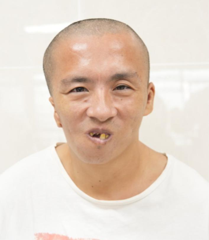 走失者照片 厦门市寻亲：中年男子被救助，疑似姓...