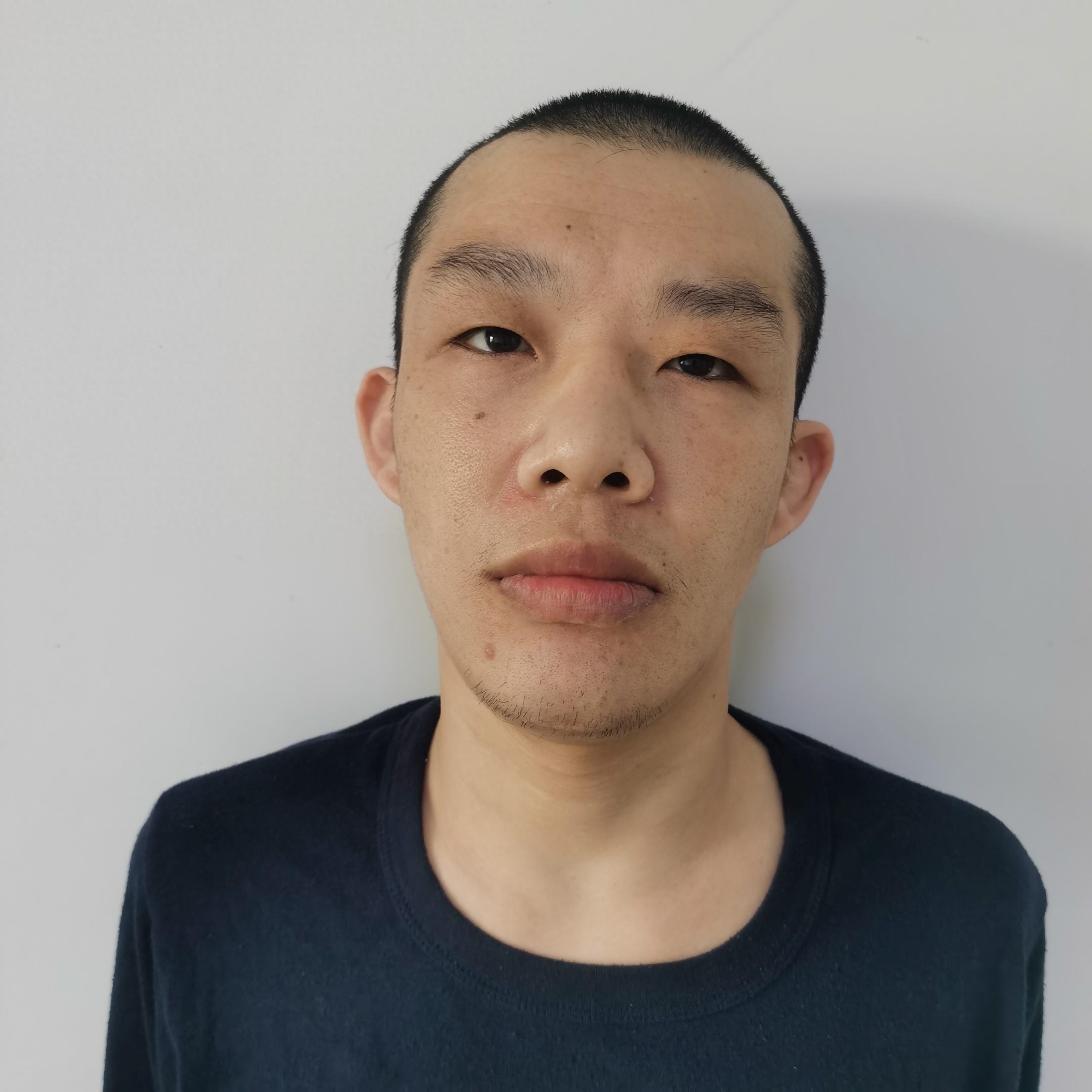 走失者照片 北京市寻亲：青年男子被救助，高1米...
