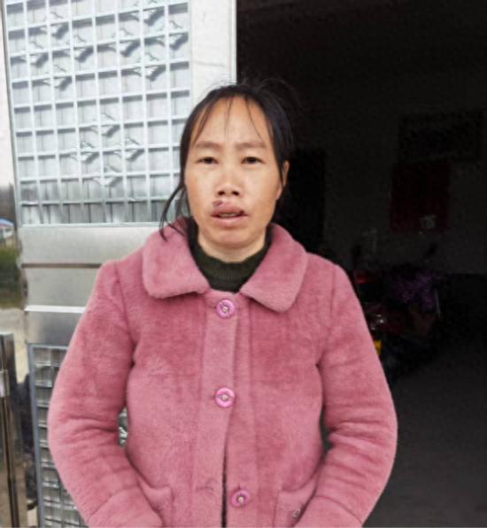 走失者照片 岳阳市寻亲：青年女子被救助，自述叫...